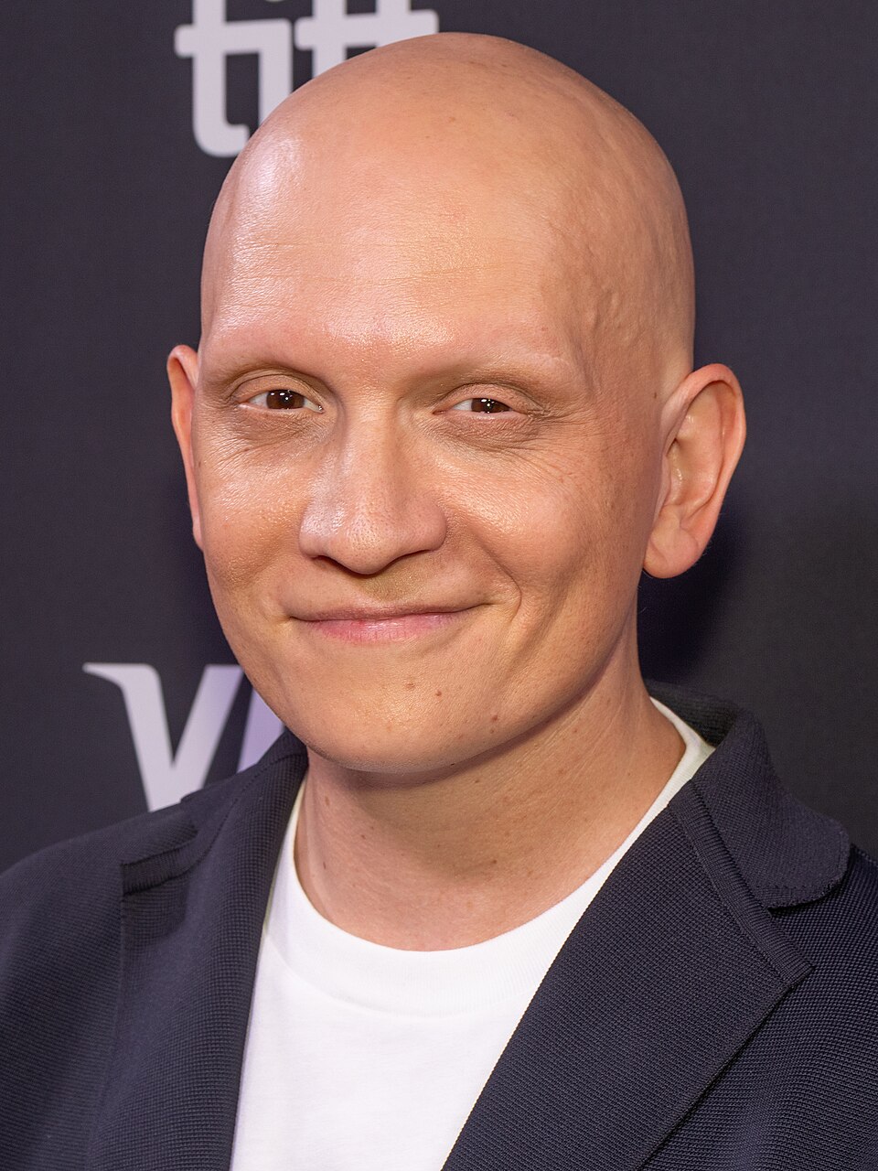 Anthony carrigan